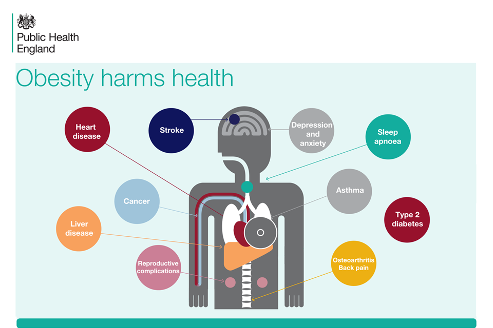 Obesity harms health